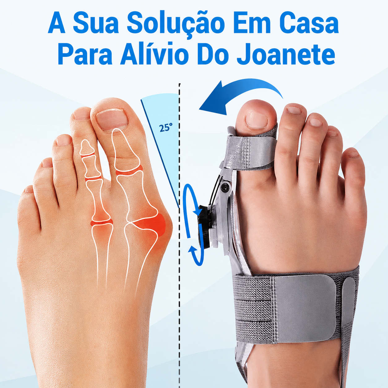 Dovrix™ Correção de joanetes